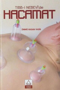 Tıbb-ı Nebevi'de Hacamat